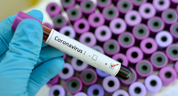 Prueba de coronavirus. 