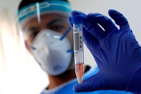 Un trabajador de salud sostiene una muestra de prueba de coronavirus. 