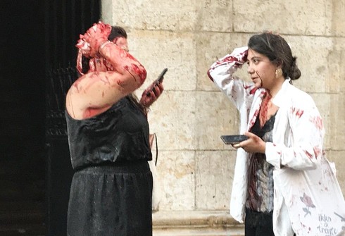 Mujeres heridas tras la explosión en el puerto de Beirut. 