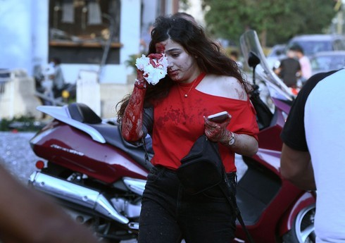 Una mujer herida en Beirut.