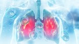 Los pulmones un paciente con EPOC y COVID-19 podrán ser tratados con el dispositivo Pulshaler de Respinova. 