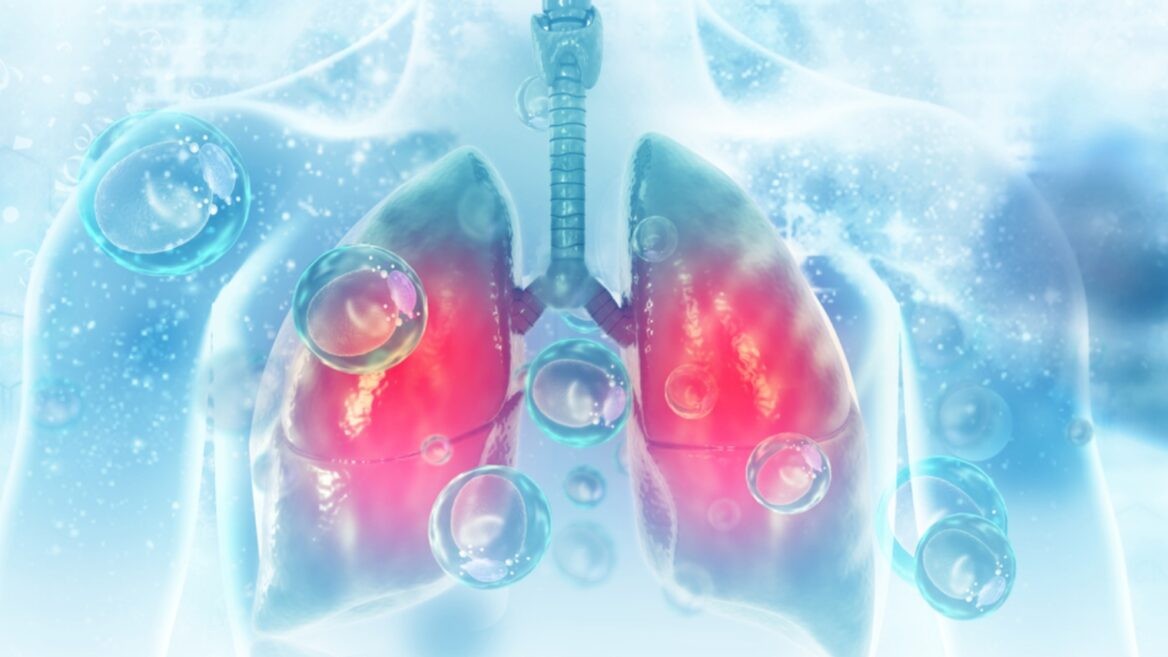 Los pulmones de un paciente con EPOC y COVID-19 podrán ser tratados con el nuevo dispositivo. 