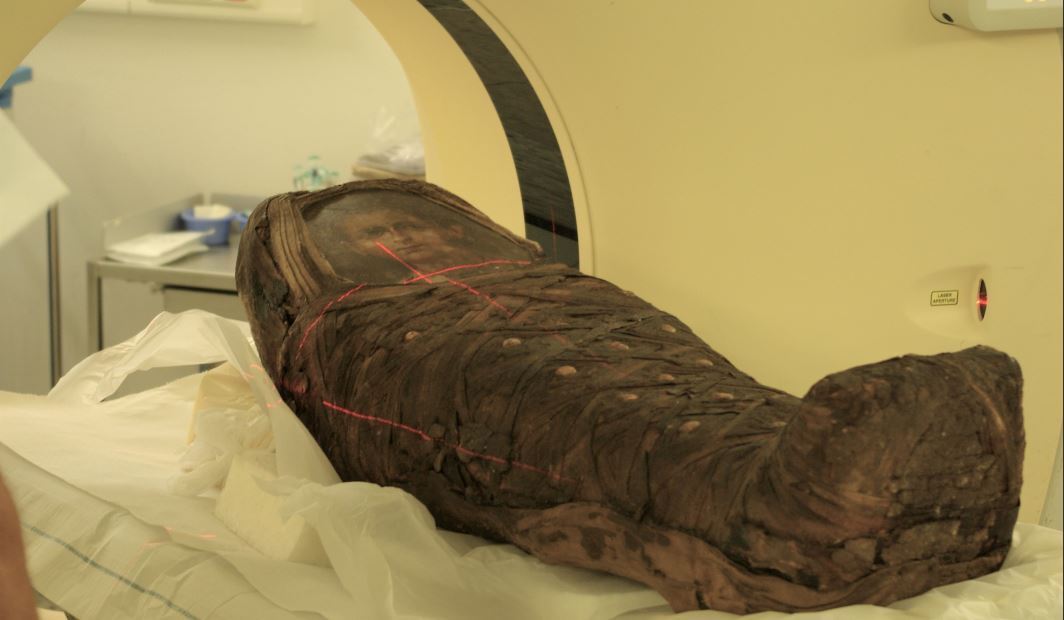 La momia del niño es sometida a una tomografía computarizada.