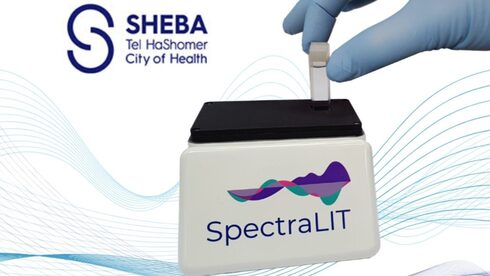 En el Centro Médico Sheba se está probando el nuevo dispositivo rápido para detección de coronavirus. 