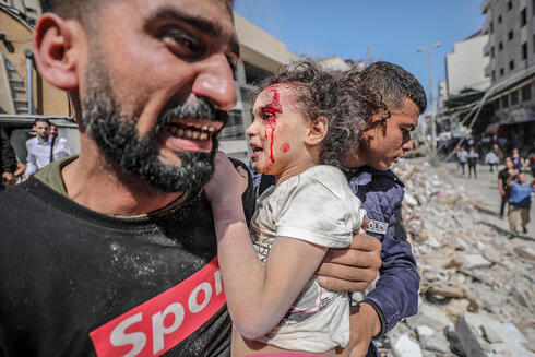 Una de las fotos de niños palestinos heridos difundidas por los medios internacionales.