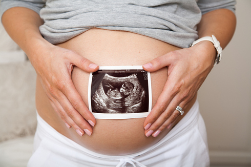 Los investigadores recomiendan realizar la prueba de amniocentesis.