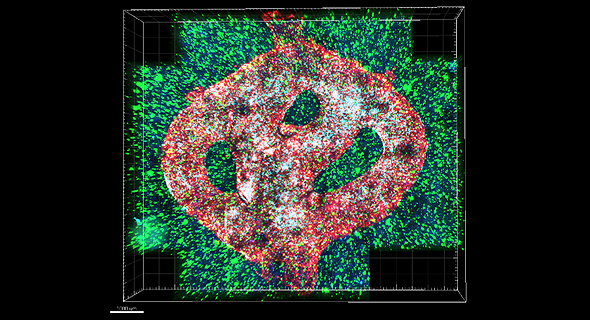 Una imagen microscópica del modelo de glioblastoma bioimpreso en 3D.  
