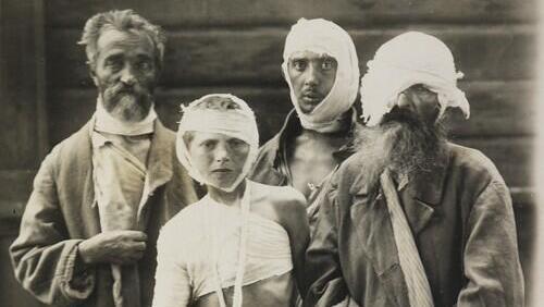 Judíos heridos en un pogromo de Kiev. 
