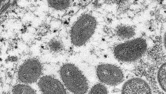 El virus de la viruela del mono bajo el microscopio.