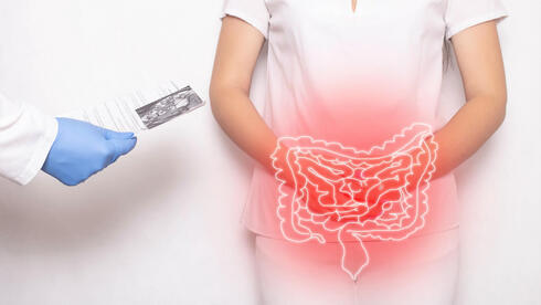 Ilustración de la necesidad de detectar el cáncer de colon.