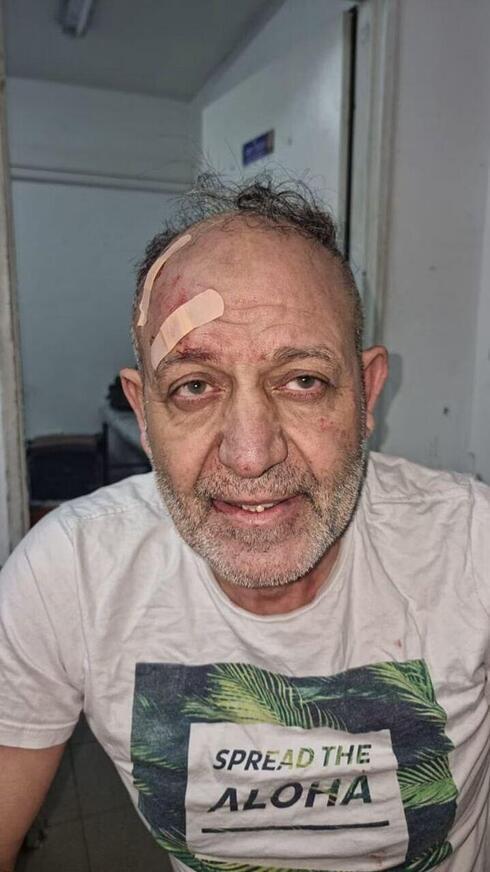 Basam al-Saadi, líder en Cisjordania de la Yihad Islámica, después de su arresto. 