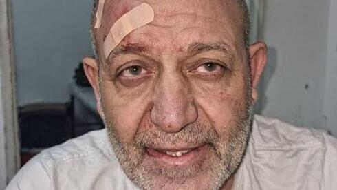 Basam al-Saadi, líder en Cisjordania de la Yihad Islámica, después de su arresto. 