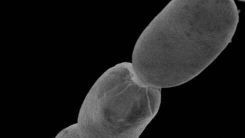 Bacterias vistas bajo el microscopio. 