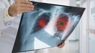 Las imágenes de rayos X son imprescindibles para brindar diagnóstico. 