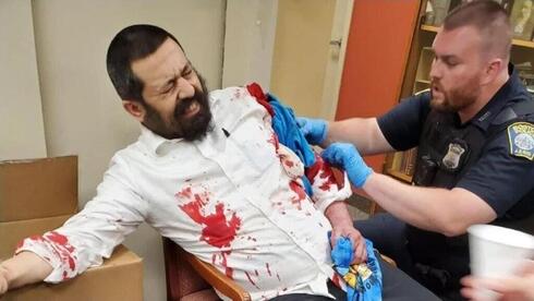 El rabino Shlomo Noginski tras ser agredido en 2021.