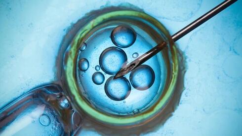 Proceso de fertilización in vitro. 