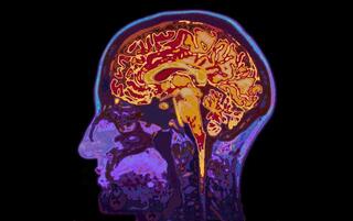 Pensamiento cerebro