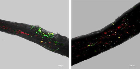 Las imágenes de fluorescencia y campo claro revelan que durante la sequía, a la izquierda, la raíz de un árbol está más densamente colonizada por dos bacterias beneficiosas.