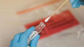 Prueba contra el COVID-19.