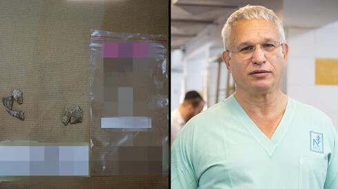 El director del Instituto de Medicina Forense, Dr. Chen Kugel; los pequeños huesos que ayudaron a identificar la muerte de israelíes durante el "Sábado Negro". 
